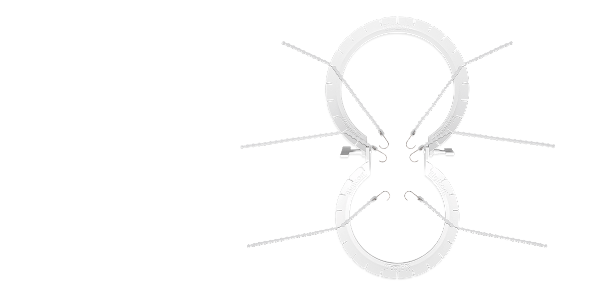 Rigicon&reg;<br> Cerrahi Retrakt&ouml;r Kiti